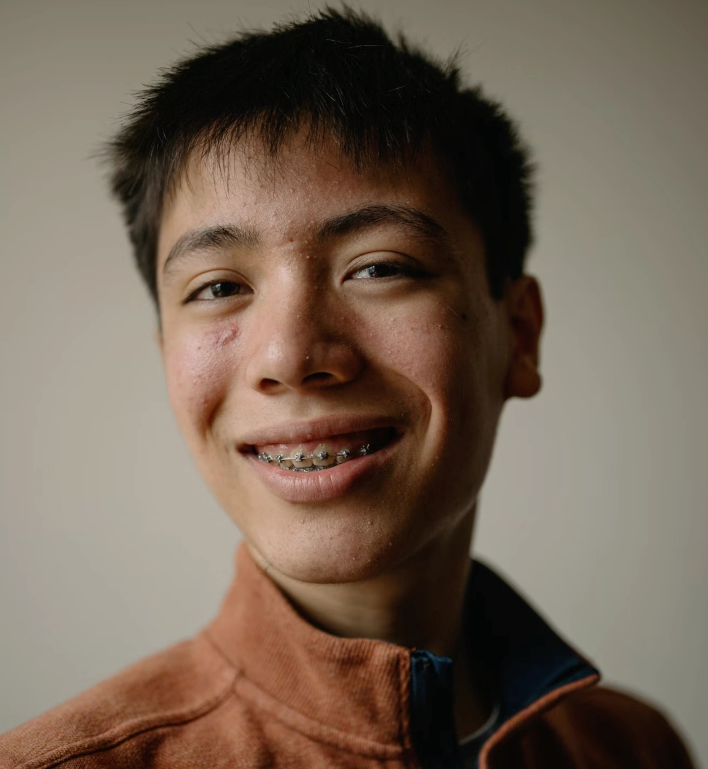 15岁的多布罗辛斯基还带着牙套